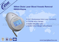 5HZ 980nm Diyot Lazer Kan Damarı Örümcek Damar Temizleme Güzellik Makinesi