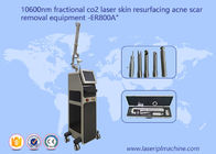 Akne Skar Streç İşareti Temizleme için 10600nm Cool Beam Fraksiyonel Co2 Lazer Makinesi