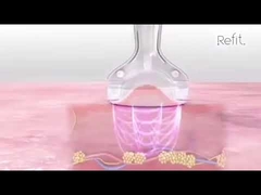 MLS05 Taşınabilir 40K Kavitasyon Vakum RF Ultrasonik Selülit Azaltma Cihazı