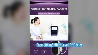 Non İnvaziv 60W Göz Bakımı Pürüzsüz İnce Çizgiler Çok Seviyeli Radyo Frekans Cihazı