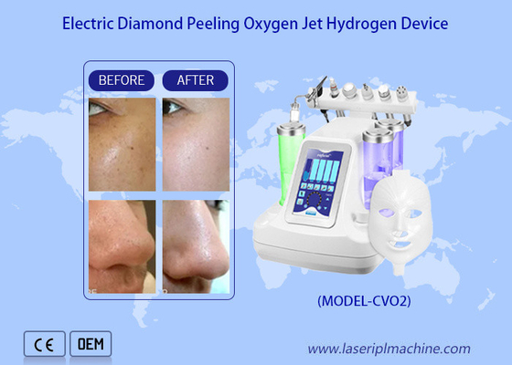 Yüzün Derin Temizlenmesi Su Oksijen Jet Peeling Makinesi / hidro Dermabrasyon Su Oksijen Jet Derin cilt temizliği