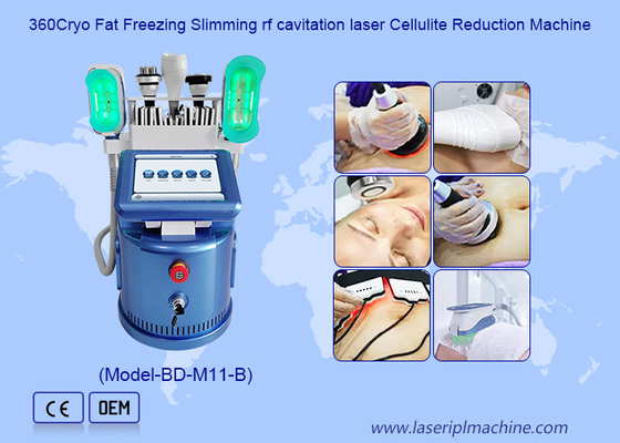 360 Cryo Vacuum Rf Lipo Laser 6 In 1 Fat Freezing Ağırlık kaybı vücut zayıflatma makinesi