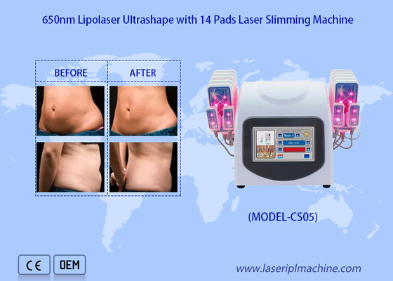 Selülit Yağ Giderimini Azaltmak İçin 650nm Lipo Lazer Pedleri Lazer Liposuction Makinesi