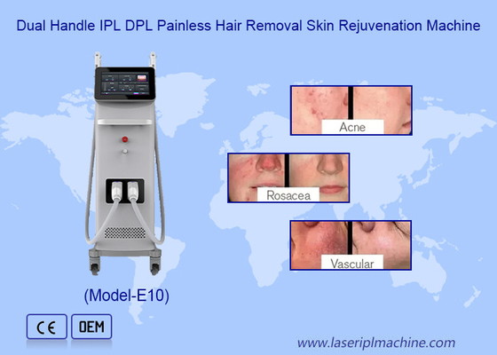 Profesyonel Kalıcı IPL OPT Epilatör Deri Yenilenme Saç Kaldırma Makinesi