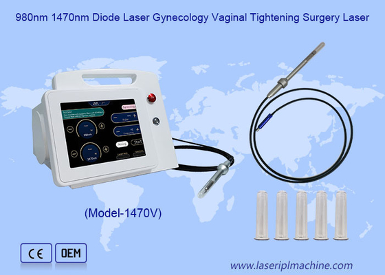 980nm 1470nm Diyot Lazer  Jinekoloji  Vajinal  Sıkılaştırma  Ameliyat Lazer