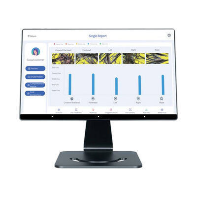 4 Dilde Akıllı Al Saç Derisi Analiz Cihazı Saç Derisi Bakımı Hedefli Kafa Makinesi